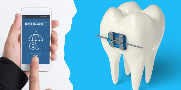 Best Dental Plans That Include Orthodontics